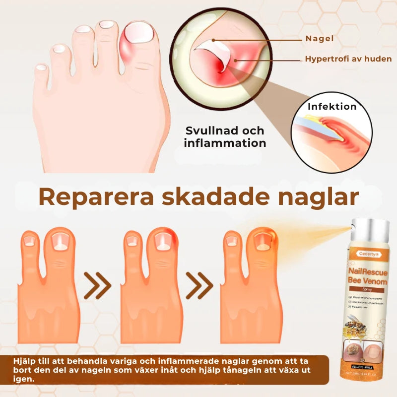 Crucial® NailRescue Nagel Spray