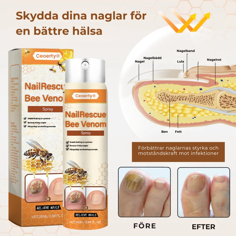 Crucial® NailRescue Nagel Spray