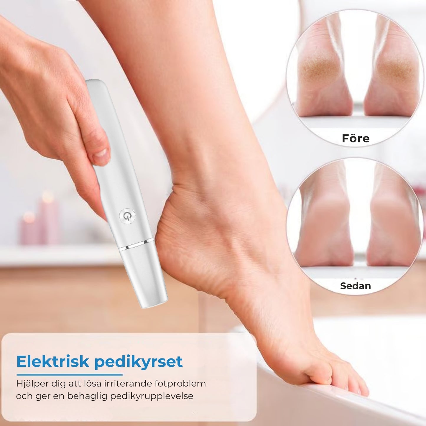 Elektrisk borttagare av förhårdnader 🎁 Inklusive utbyteshuvud🎁