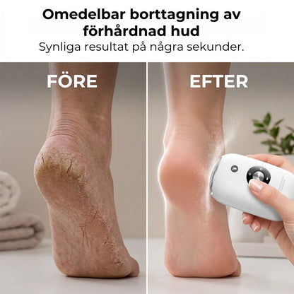 Automatisk Pedikyrmaskin
