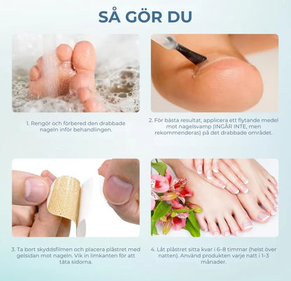 Plåster För Nagelsvamp – Snabbverkande Behandling