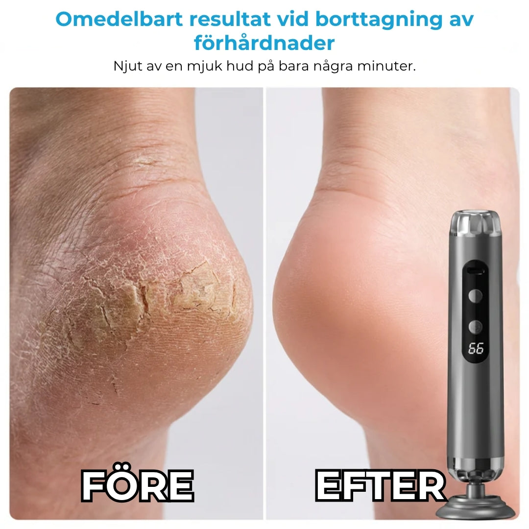 Elektrisk fotslipmaskin med 5 hastigheter