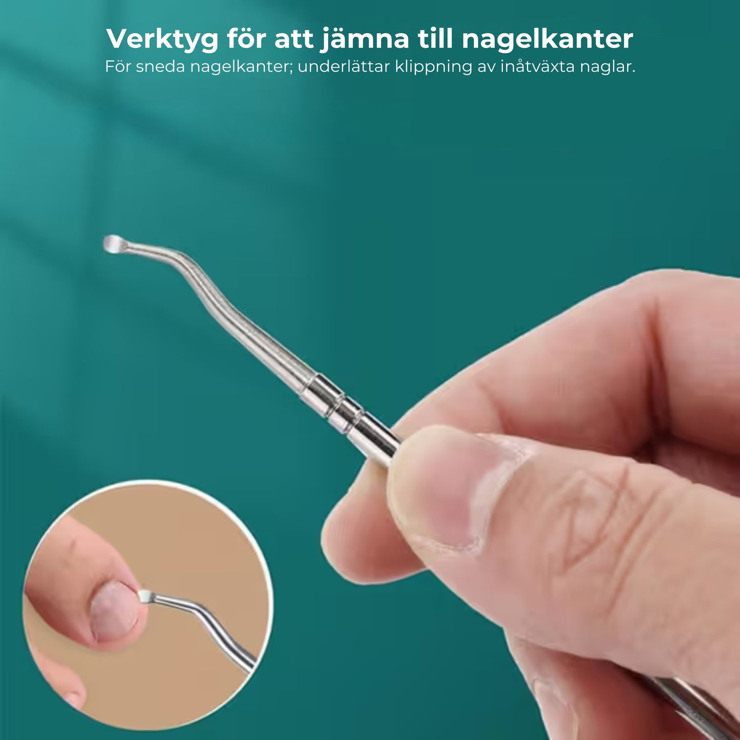 Nagelklipparset mot inåtväxta naglar