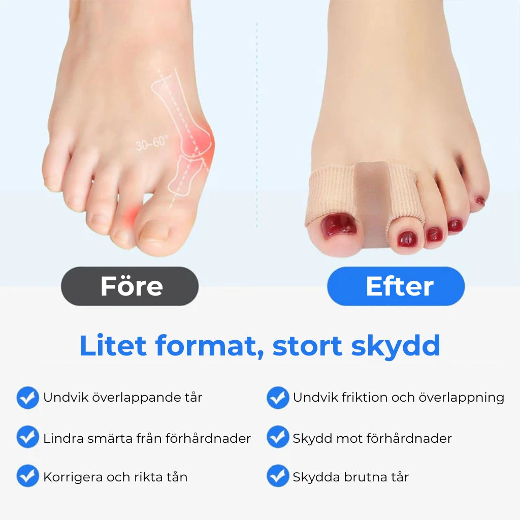 Ergonomisk tåspridare – 2 stycken