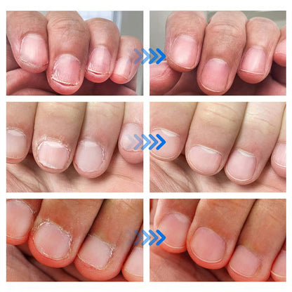 Nail Repair Gel - Läker och återställer dina naglar