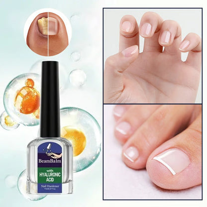 Nail Repair Gel - Läker och återställer dina naglar