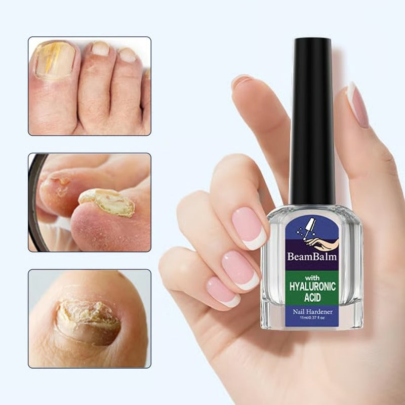 Nail Repair Gel - Läker och återställer dina naglar